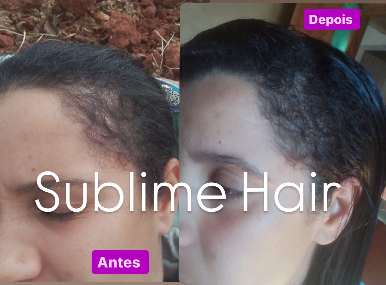 Resultado Sublime Hair